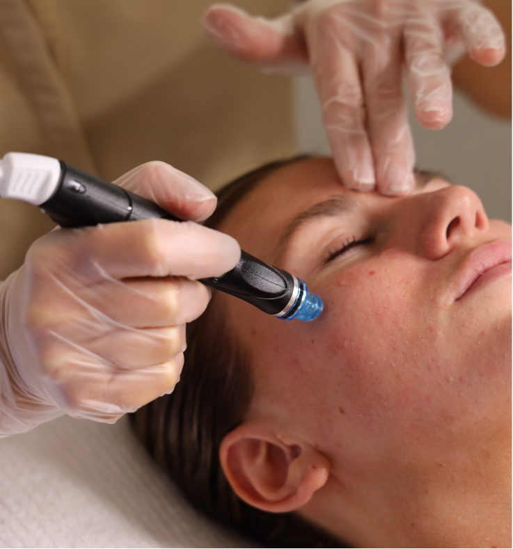 Hydrafacial
